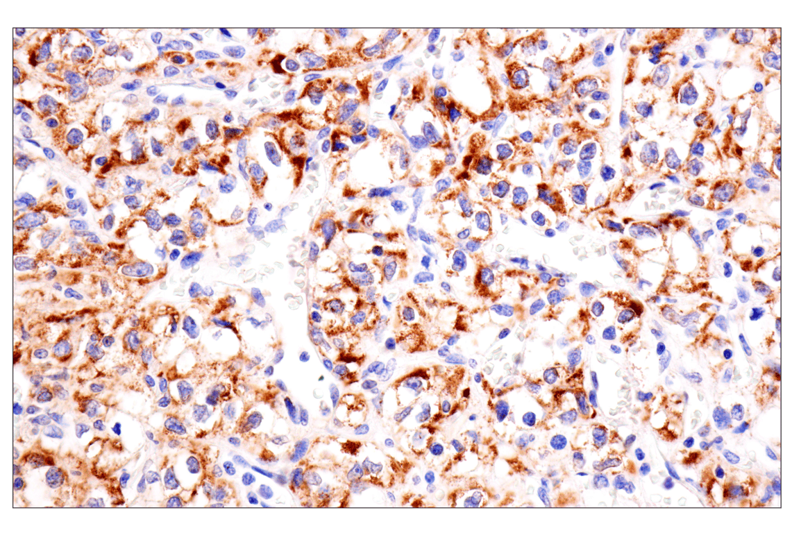 Immunohistochemistry Image 5: AMACR (F7T6V) Rabbit Monoclonal Antibody
