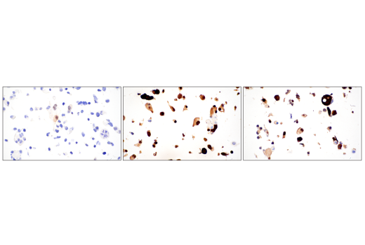 Immunohistochemistry Image 6: YAP/TAZ (E9M8G) Rabbit Monoclonal Antibody (BSA and Azide Free)