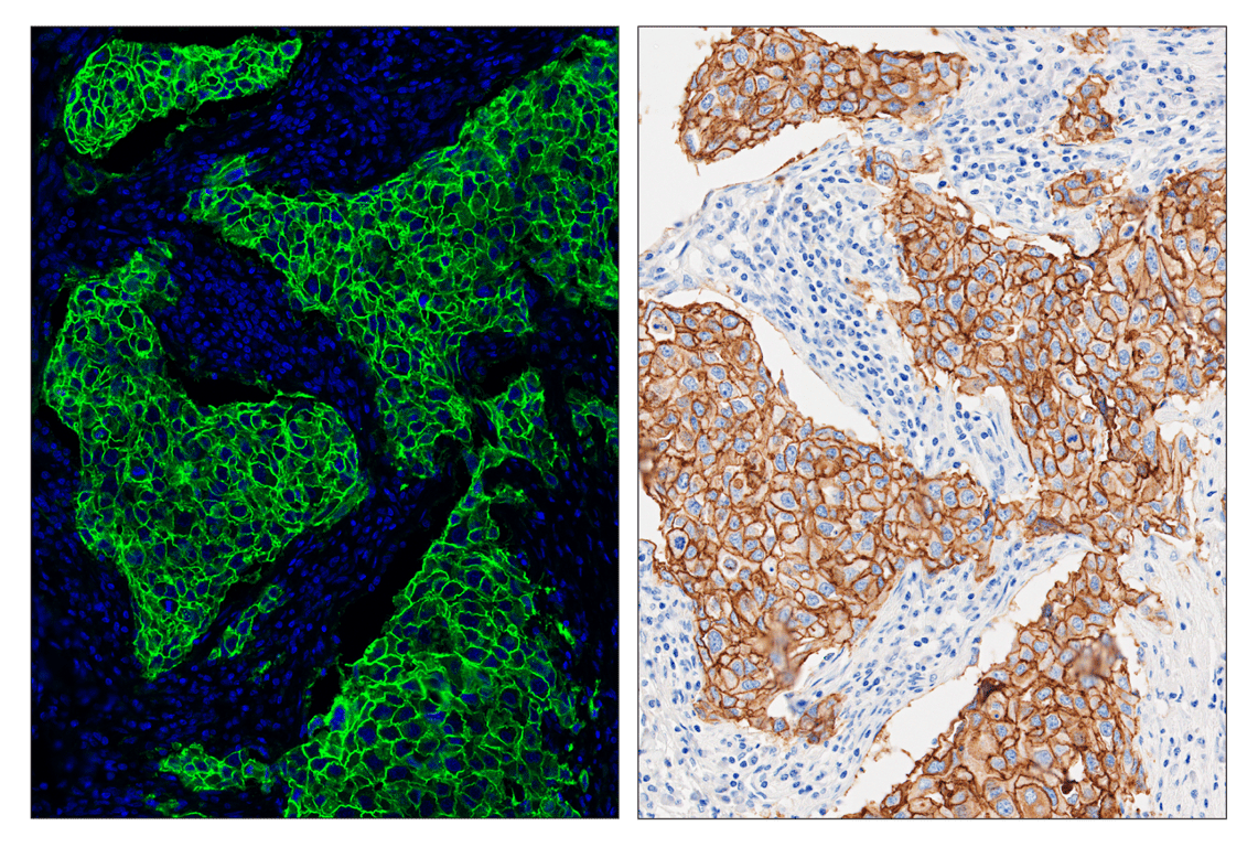 undefined Image 4: SignalStar<sup>™</sup> Midplex IHC Buffer Kit