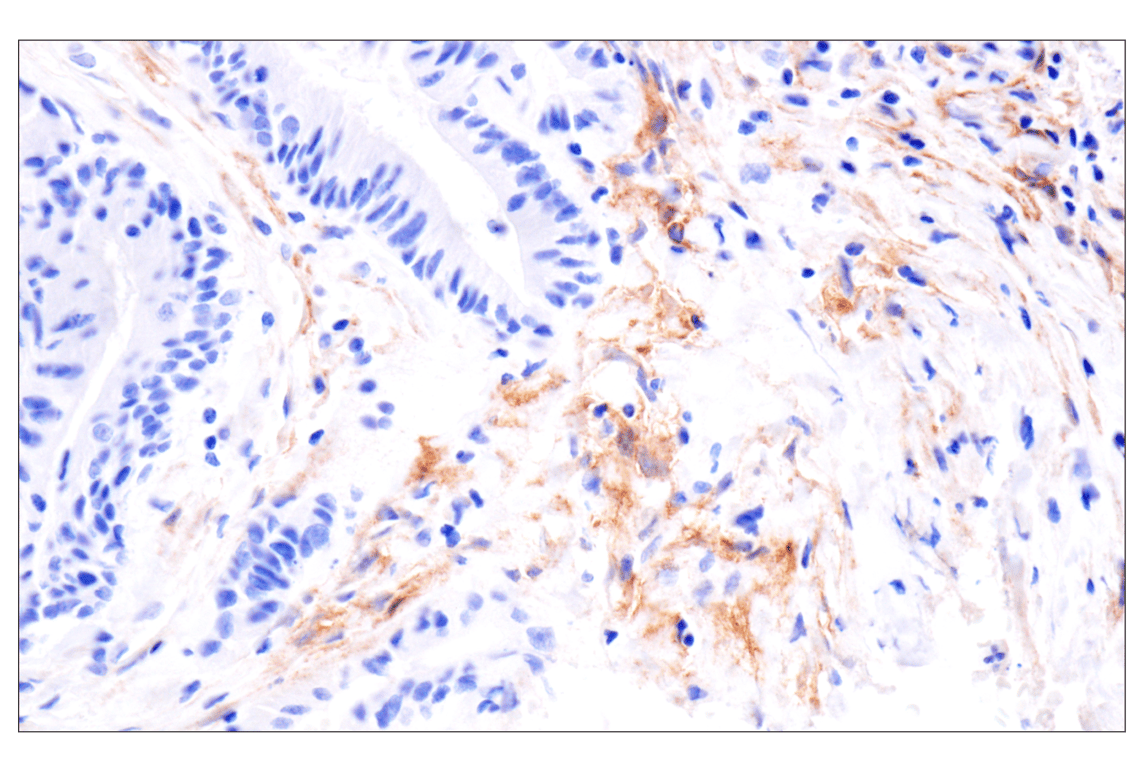 Immunohistochemistry Image 4: LRRC15 (E4X8J) Rabbit Monoclonal Antibody