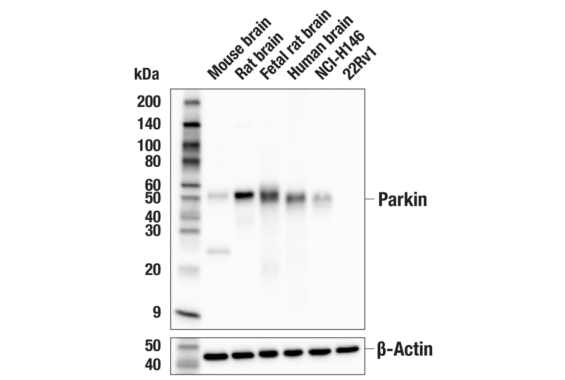 Western Blotting Image 1: Parkin (E6B1P) Mouse mAb