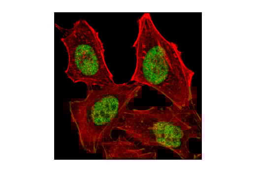 Immunofluorescence Image 1: MSH2 (D24B5) Rabbit Monoclonal Antibody (BSA and Azide Free)