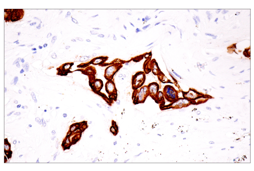 Immunohistochemistry Image 3: Keratin 7 (RN7) Mouse Monoclonal Antibody