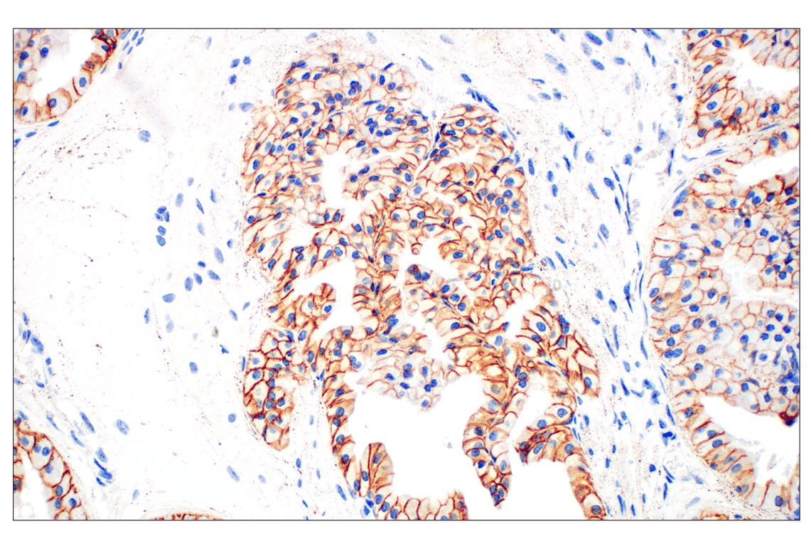 Immunohistochemistry Image 3: E-Cadherin (24E10) Rabbit Monoclonal Antibody (BSA and Azide Free)