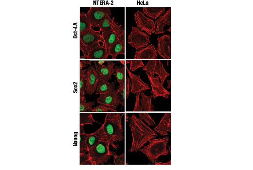 undefined Image 2: StemLight<sup>™</sup> Pluripotency IF Antibody Sampler Kit