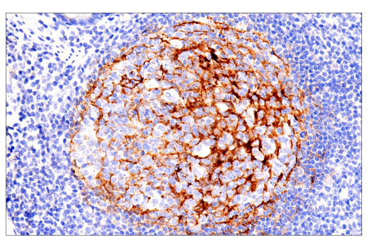 Immunohistochemistry Image 1: CD21/CR2 (2G9) Mouse mAb