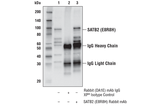 Immunoprecipitation Image 1: SATB2 (E8R8H) Rabbit Monoclonal Antibody