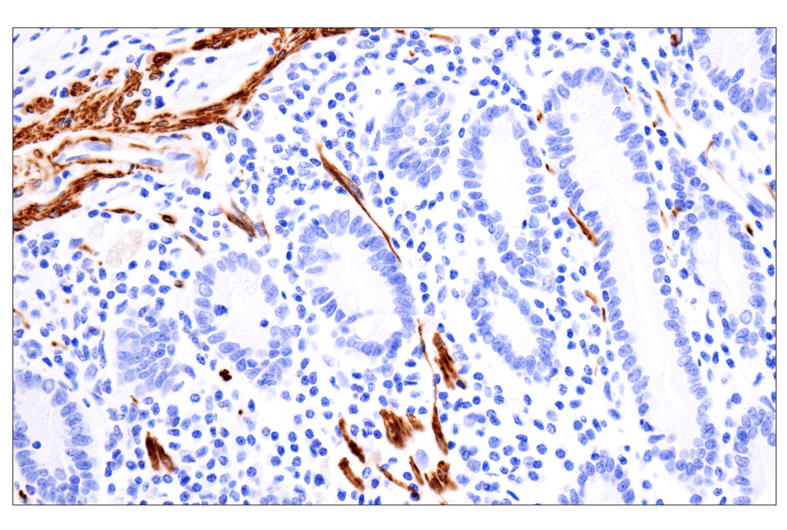 Immunohistochemistry Image 10: Desmin (F5V4I) Rabbit Monoclonal Antibody (BSA and Azide Free)