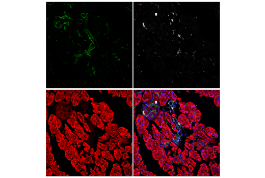 Immunofluorescence Image 3: Phospho-Paxillin (Tyr118) (E9U9F) Rabbit Monoclonal Antibody
