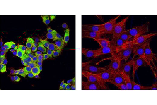 Immunofluorescence Image 1: Insulin (C27C9) Rabbit Monoclonal Antibody