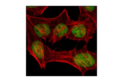 Immunofluorescence Image 1: MSH2 (3A2) Mouse Monoclonal Antibody