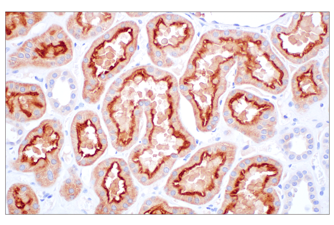 Immunohistochemistry Image 3: Folate Receptor Alpha/FOLR1 (E8U2F) Mouse Monoclonal Antibody (BSA and Azide Free)
