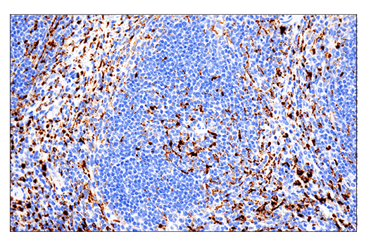 Immunohistochemistry Image 1: CD68 (E3O7V) Rabbit Monoclonal Antibody
