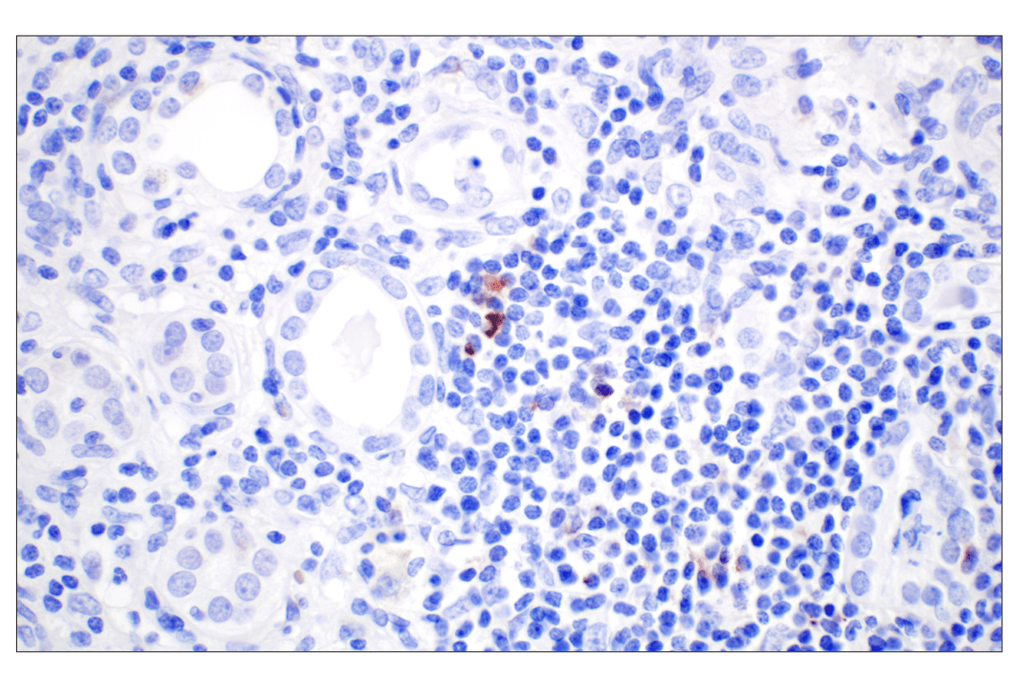 CXCL13 (F6A4R) Rabbit mAb | Cell Signaling Technology