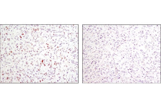 Immunohistochemistry Image 1: Phospho-c-Jun (Ser73) (D47G9) Rabbit Monoclonal Antibody