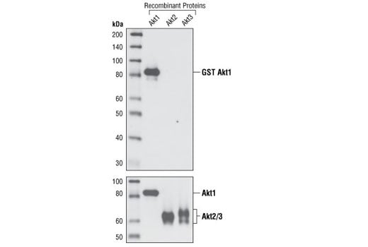 undefined Image 13: Phospho-Akt Isoform Antibody Sampler Kit