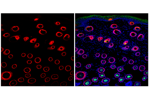 Immunofluorescence Image 1: Keratin 17/19 (D4G2) Rabbit Monoclonal Antibody (BSA and Azide Free)