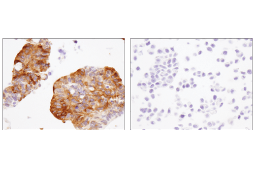 Immunohistochemistry Image 1: MX1 (D3W7I) Rabbit Monoclonal Antibody
