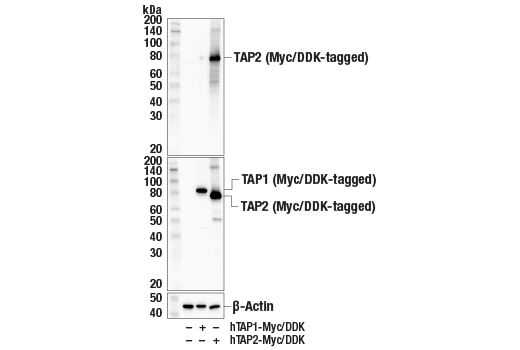 undefined Image 15: MHC Class I Antigen Processing and Presentation Antibody Sampler Kit