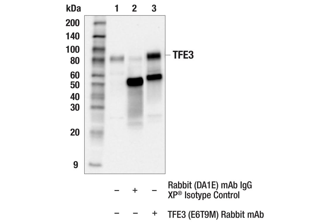 Immunoprecipitation Image 1: TFE3 (E6T9M) Rabbit Monoclonal Antibody