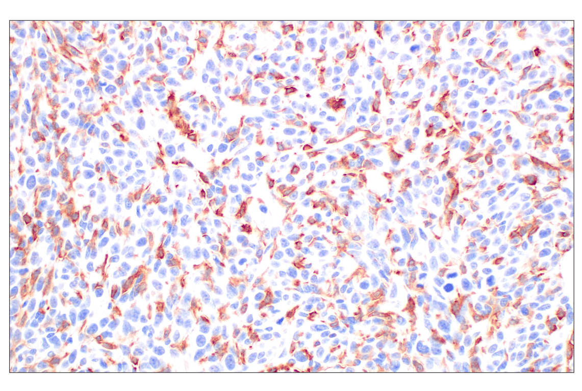 Immunohistochemistry Image 1: DAP12 (F1Q2P) Rabbit Monoclonal Antibody