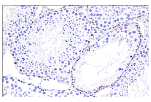 Immunohistochemistry Image 4: RUNX3/AML2 (D6E2) Rabbit Monoclonal Antibody