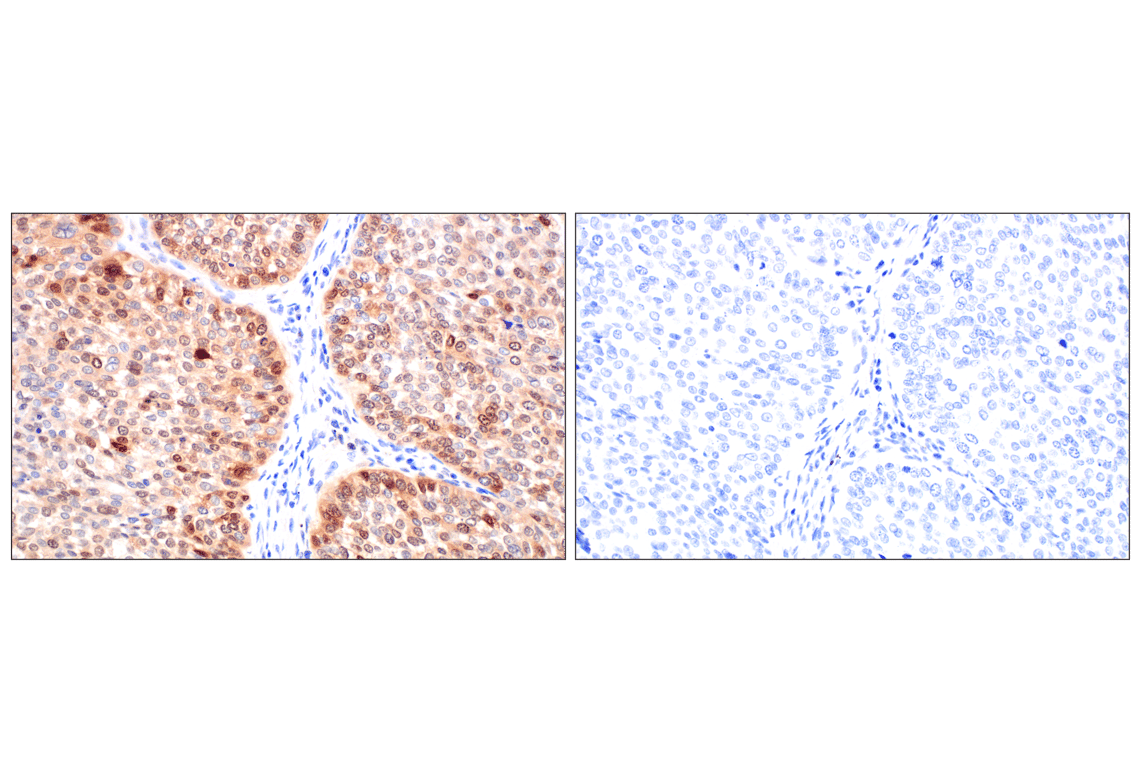 Immunohistochemistry Image 17: CDK6 (E3E3Q) Rabbit Monoclonal Antibody