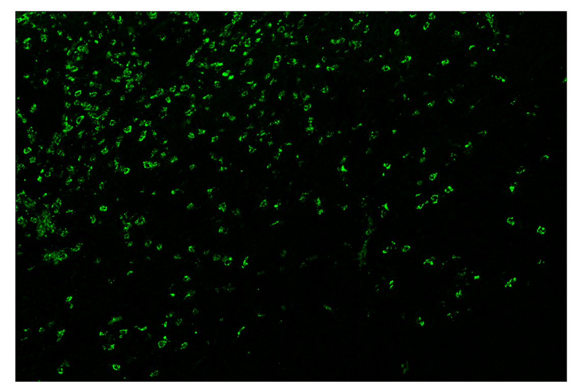 Immunohistochemistry Image 2: Myeloperoxidase (E1E7I) & CO-0138-750 SignalStar<sup>™</sup> Oligo-Antibody Pair