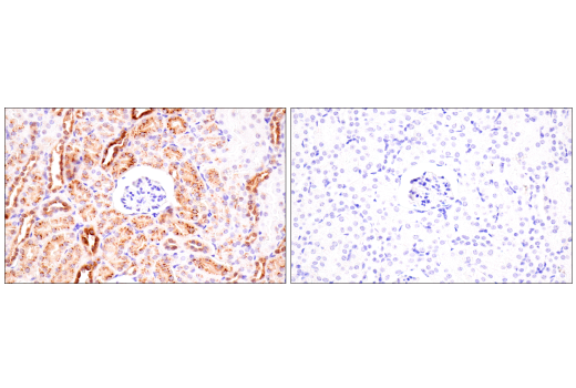 Immunohistochemistry Image 5: Osteopontin/SPP1 (E9Z1D) Rabbit Monoclonal Antibody (BSA and Azide Free)