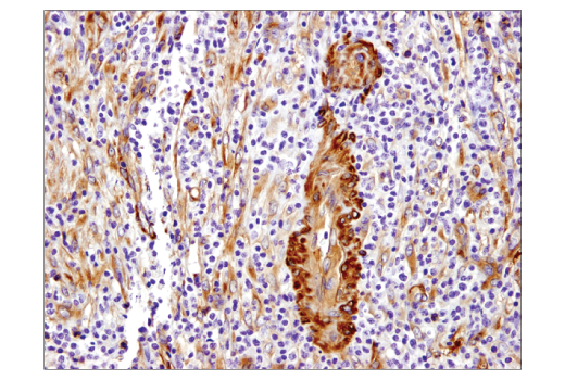 Immunohistochemistry Image 1: Vinculin (E1E9V) Rabbit Monoclonal Antibody (BSA and Azide Free)