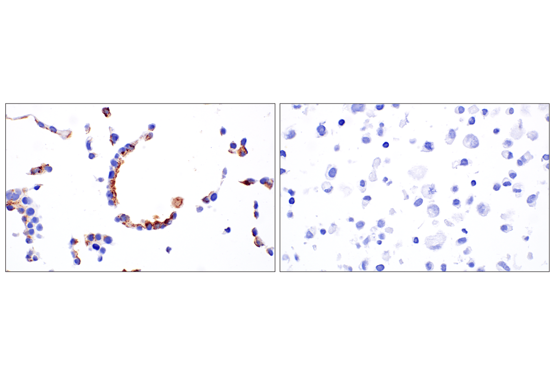 Immunohistochemistry Image 10: IGFBP2 (F3E6V) Rabbit Monoclonal Antibody