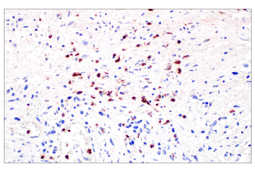 Immunohistochemistry Image 3: MMP-8 (E1C4L) Rabbit Monoclonal Antibody