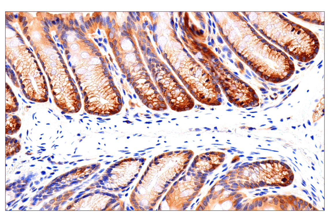 Immunohistochemistry Image 5: Caspase-8 (F5K9P) Rabbit mAb