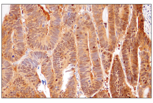 Immunohistochemistry Image 5: IDH1 (RcMab-1) Rat Monoclonal Antibody