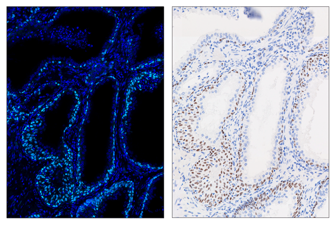 Immunohistochemistry Image 3: p63 (D9L7L) & CO-0161-750 SignalStar<sup>™</sup> Oligo-Antibody Pair