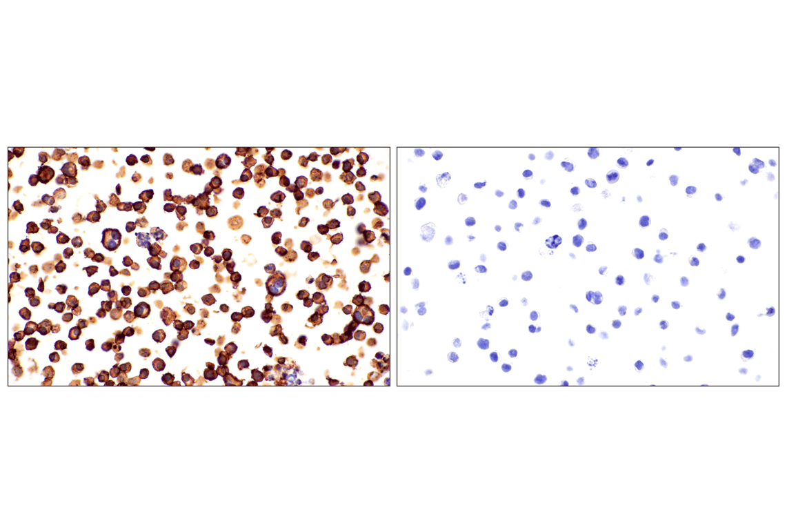 Immunohistochemistry Image 18: Syndecan 1 (E7F7T) Rabbit Monoclonal Antibody (BSA and Azide Free)