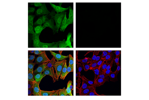 Immunofluorescence Image 1: Thymidine Kinase 1 (E2H7Z) Rabbit Monoclonal Antibody