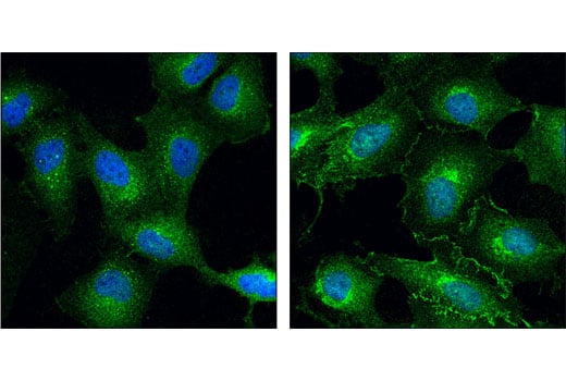 Immunofluorescence Image 1: CDC37 (D11A3) Rabbit Monoclonal Antibody