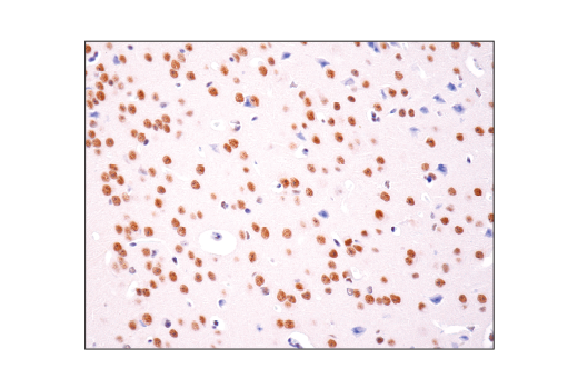 Immunohistochemistry Image 3: HAUSP (D17C6) Rabbit Monoclonal Antibody