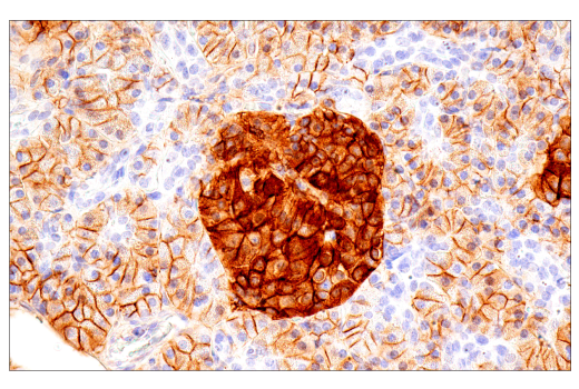 Immunohistochemistry Image 9: CD99 (PCB1) Mouse mAb