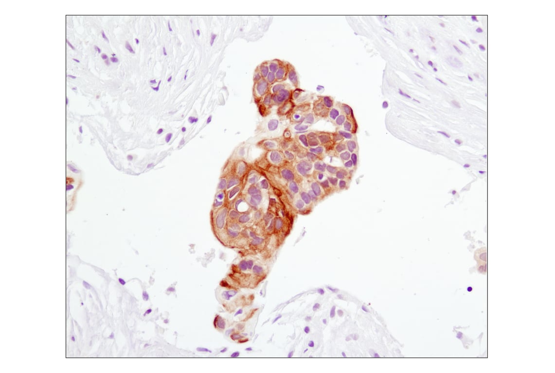 Immunohistochemistry Image 1: Phospho-Akt (Ser473) (D9E) XP<sup>®</sup> Rabbit mAb (BSA and Azide Free)