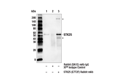 Immunoprecipitation Image 1: STK25 (E7T2F) Rabbit Monoclonal Antibody
