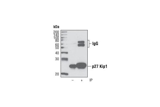 Immunoprecipitation Image 1: p27 Kip1 (D37H1) Rabbit Monoclonal Antibody