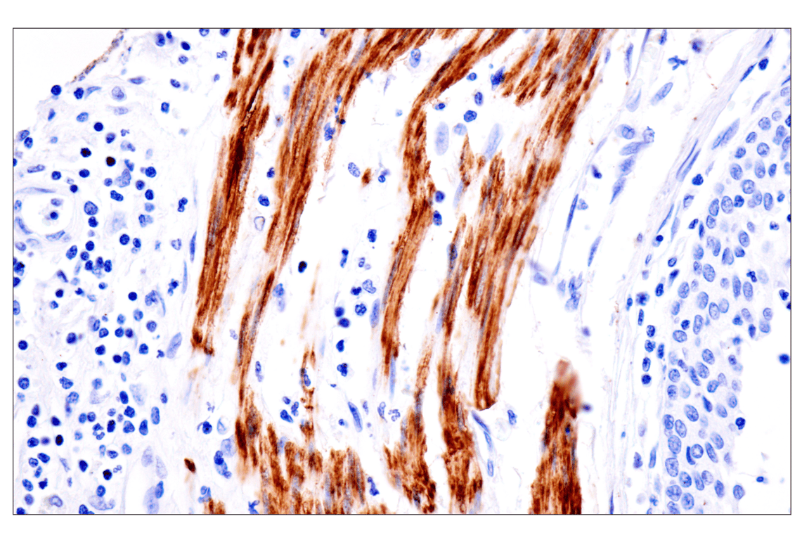 Immunohistochemistry Image 3: Desmin (F5V4I) Rabbit Monoclonal Antibody (BSA and Azide Free)
