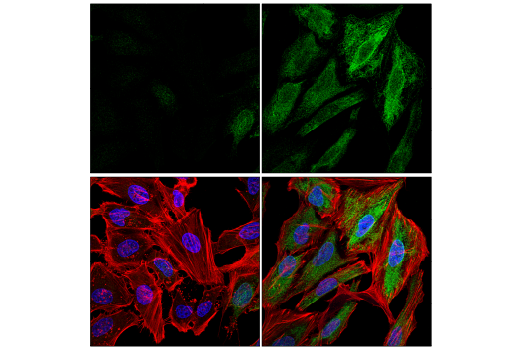 Immunofluorescence Image 1: HO-1 (E7U4W) Rabbit Monoclonal Antibody