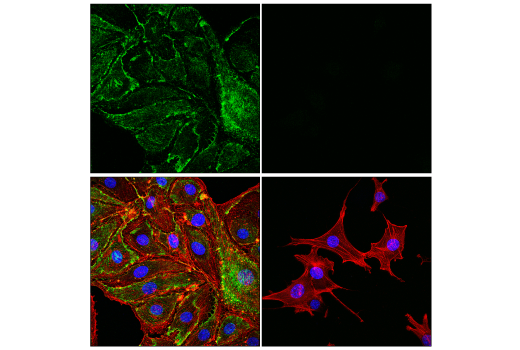 Immunofluorescence Image 1: PLVAP (E9W8D) Rabbit Monoclonal Antibody