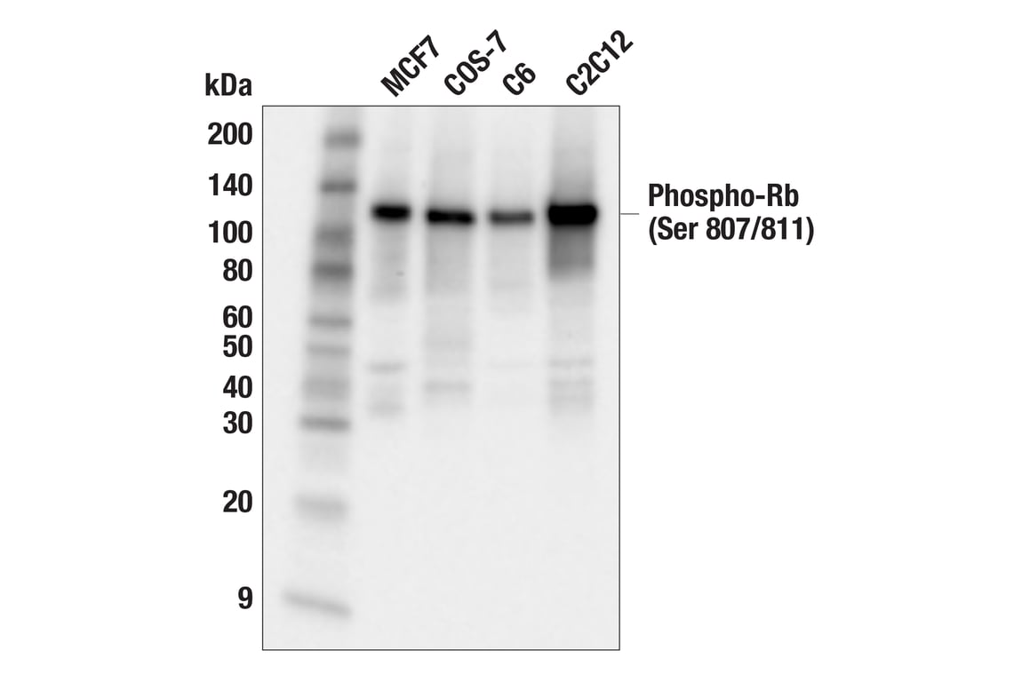 undefined Image 34: Rb Antibody Sampler Kit