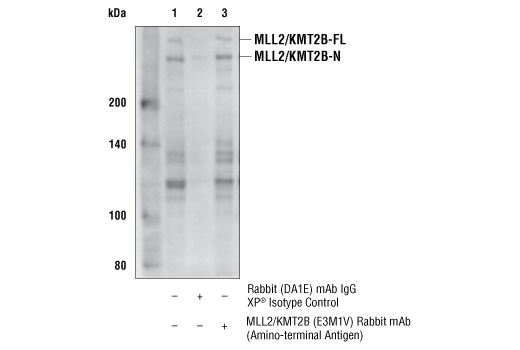 Immunoprecipitation Image 1: MLL2/KMT2B (E3M1V) Rabbit Monoclonal Antibody (Amino-terminal Antigen)