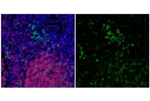 Immunofluorescence Image 1: TACI/TNFRSF13B/CD267 (E3P6X) Rabbit Monoclonal Antibody