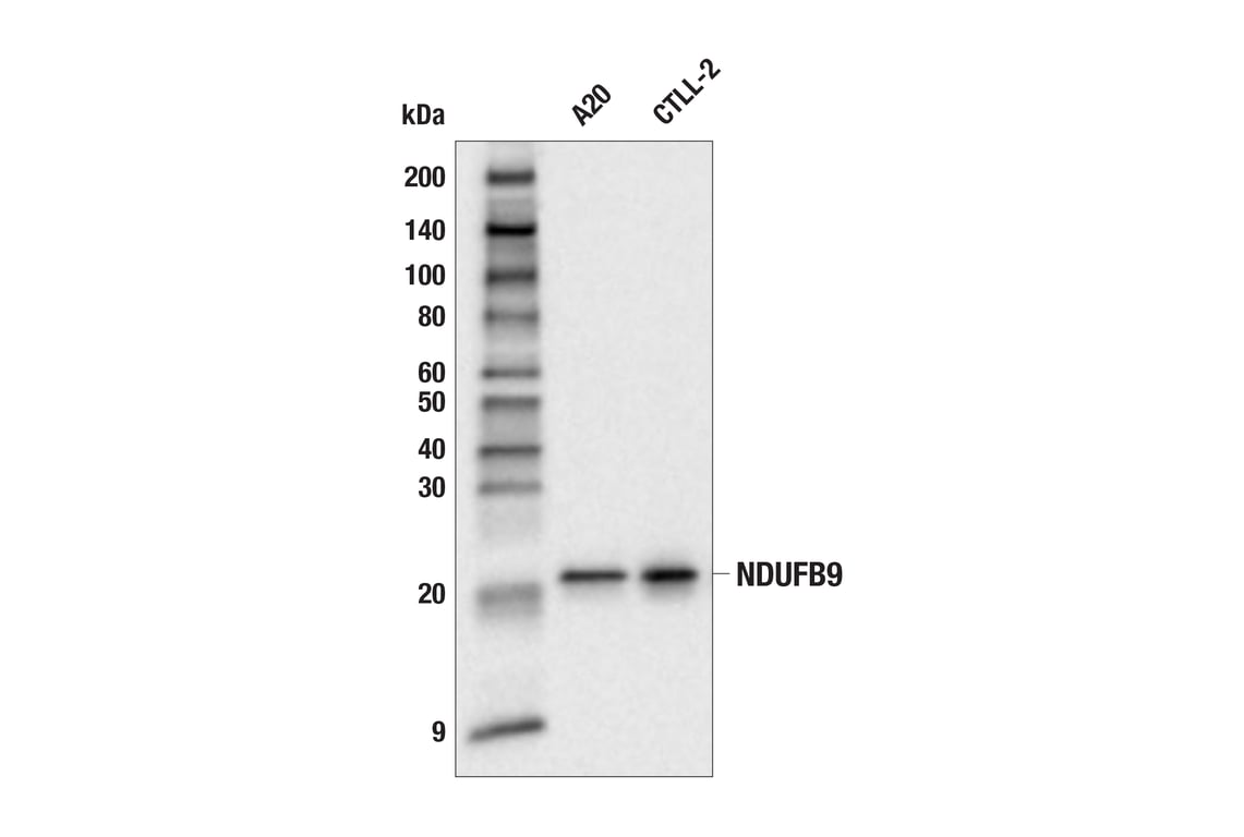 Western Blotting Image 2: NDUFB9 (E7W6K) Rabbit Monoclonal Antibody